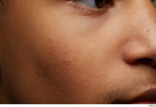 HD Face Skin Purcell Sutton cheek skin pores skin texture…